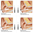 Limpador de Ouvido com Câmera HD – Visualize e Limpe com Segurança